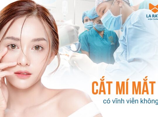 Cắt mí mắt có được vĩnh viễn không? Duy trì được bao lâu?